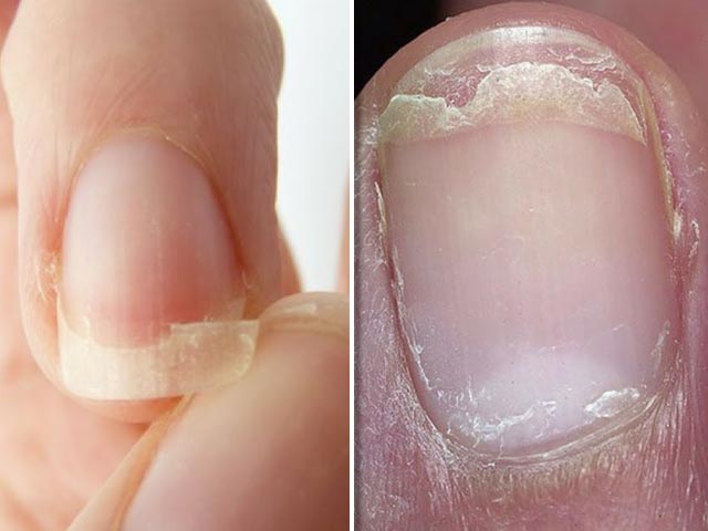 770a3f48-5-amazing-tips-for-fragile-nails-640x480